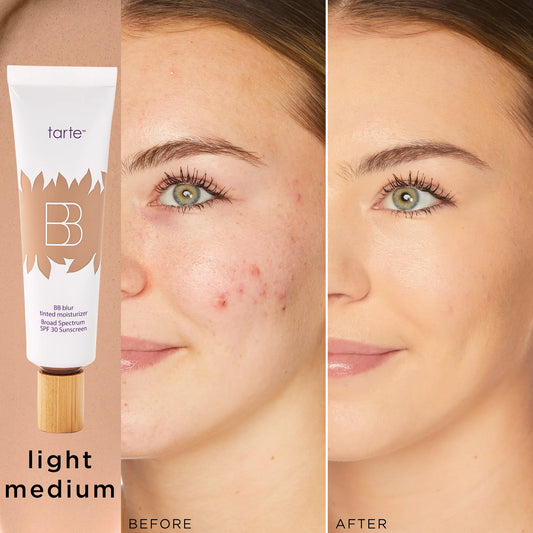 Tarte BB Blur Tinted Moisturizer SPF 30 - Instantly Brightens, Hydrates & Smooths Your Skin